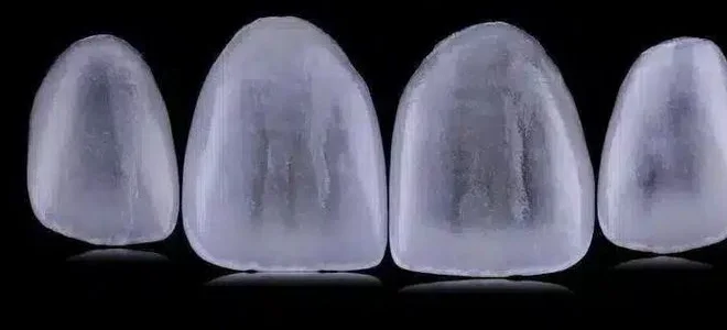 Lentes de contato dental de porcelana, quatro peças sobre fundo preto